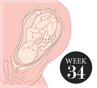 34 weken zwanger