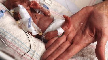 kleinste baby ter wereld